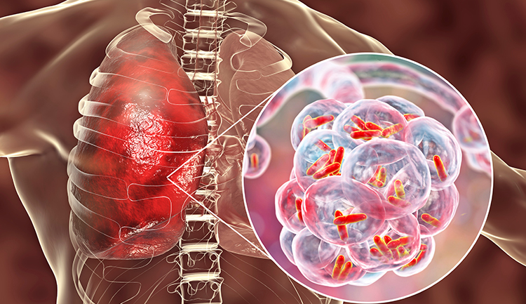 Infectious Diseases - img